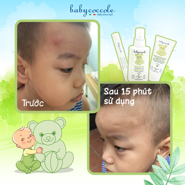 Bút chấm vết muỗi đốt chiết xuất hạnh nhân và dầu oliu Babycoccole 0M+ - Hình ảnh 4