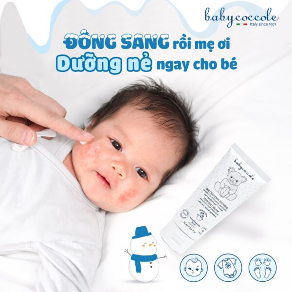 Kem nẻ và giữ ấm 2 in 1 chiết xuất sáp ong và vitamin Babycoccole 0M+ - Hình ảnh 6