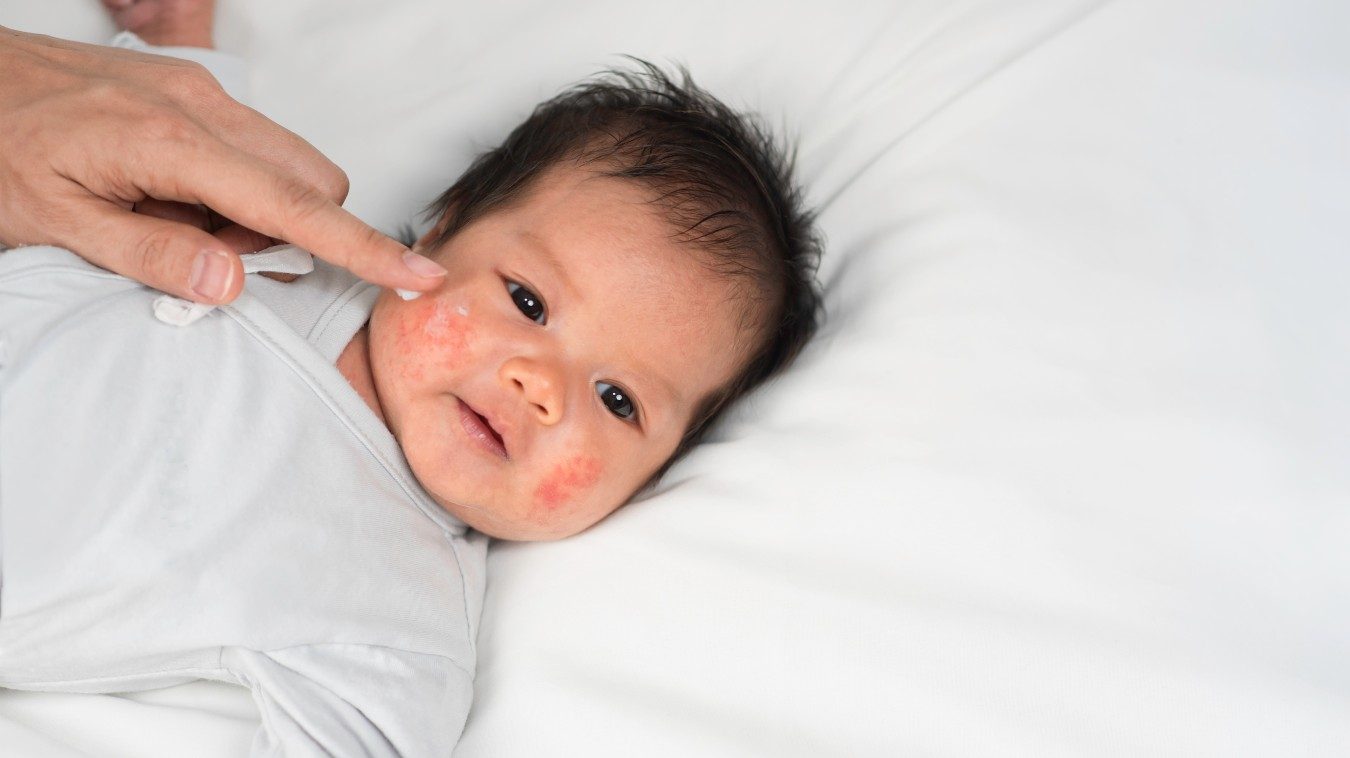 ne-cham-sua-babycoccole-2